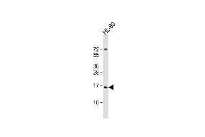Anti-KISS1 Antibody (C-Term)at 1:2000 dilution + HL-60 whole cell lysates Lysates/proteins at 20 μg per lane. (KISS1 抗体  (AA 115-145))