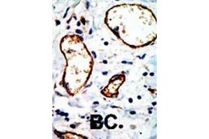 Immunohistochemistry (Paraffin-embedded Sections) (IHC (p)) image for anti-Nuclear Receptor Co-Repressor 1 (NCOR1) (AA 16-47), (N-Term) antibody (ABIN387976)