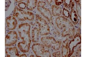 Immunohistochemistry (IHC) image for anti-ATP Synthase, H+ Transporting, Mitochondrial F1 Complex, alpha Subunit 1, Cardiac Muscle (ATP5A1) antibody (ABIN7127353)