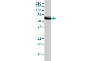 Western Blotting (WB) image for anti-RNA Guanine-7 Methyltransferase (RNMT) (AA 1-476) antibody (ABIN563757)