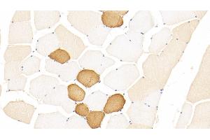 Detection of TNNT1 in Human Skeletal muscle Tissue using Polyclonal Antibody to Troponin T Type 1, Slow Skeletal (TNNT1) (TNNT1 抗体  (AA 1-259))