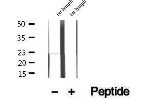 Western blot analysis of extracts of rat lymph tissue, using LAPTM4B antibody. (LAPTM4B 抗体  (Internal Region))