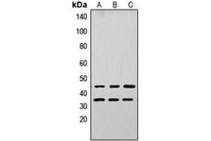 Western blot analysis of Apolipoprotein L3 expression in A549 (A), PC12 (B), NS-1 (C) whole cell lysates. (APOL3 抗体  (Center))