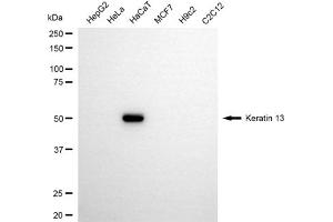 Western blotting analysis using keratin 13 antibody (ABIN7799164).