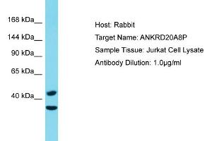Host: Rabbit Target Name: ANKRD20A8P Sample Type: Jurkat Whole Cell lysates Antibody Dilution: 1. (ANKRD20A8P 抗体  (C-Term))