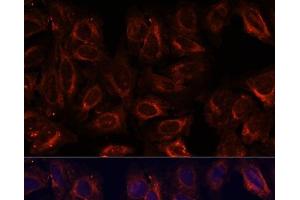 Immunofluorescence analysis of U-2 OS cells using SCGB3A2 Polyclonal Antibody at dilution of 1:100. (SCGB3A2 抗体)