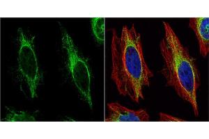 Immunofluorescence (IF) image for anti-Keratin 14 (KRT14) antibody (ABIN2855778)