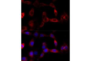 Immunofluorescence (IF) image for anti-Cytochrome P450, Family 1, Subfamily B, Polypeptide 1 (CYP1B1) (AA 1-260) antibody (ABIN3021931)