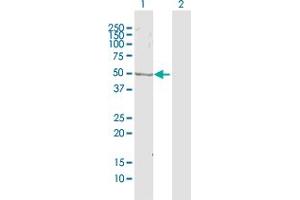 Western Blot analysis of ZWILCH expression in transfected 293T cell line by ZWILCH MaxPab polyclonal antibody. (ZWILCH 抗体  (AA 1-477))