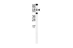 HtrA1- (ABIN388128 and ABIN2846342) western blot analysis in Hela cell line lysates (35 μg/lane). (HTRA1 抗体  (C-Term))