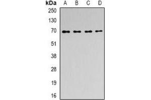 Western blot analysis of ACAD9 expression in MCF7 (A), SKOV3 (B), mouse kidney (C), rat brain (D) whole cell lysates.