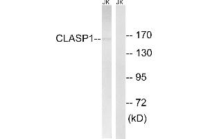Immunohistochemistry analysis of paraffin-embedded human testis tissue, using CLASP1 antibody. (CLASP1 抗体)