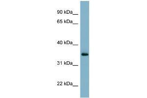 WB Suggested Anti-GEM Antibody Titration:  0. (GEM 抗体  (N-Term))