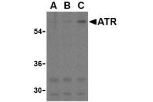 Image no. 1 for anti-anthrax Toxin Receptor 1 (ANTXR1) (C-Term) antibody (ABIN205805) (ANTXR1 抗体  (C-Term))
