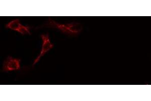 ABIN6269155 staining Hela cells by IF/ICC. (VAV1 抗体  (N-Term))