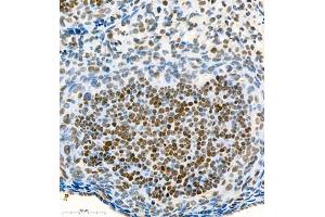 Immunohistochemistry of paraffin embedded mouse ovary using Skar (ABIN7074970) at dilution of 1:900 (400x lens) (p46 抗体)