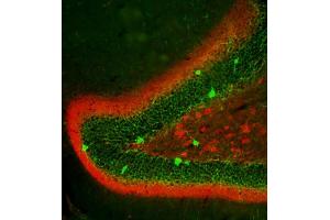Indirect immunolabeling of the dentate gyrus (PFA fixed) in mouse with anti-calretinin (red, dilution 1 : 500) and anti-parvalbumin (, green, dilution 1 : 500).