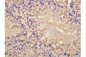 anti-Lin28A/ B (AA 75-180) antibody