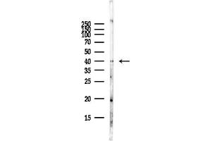 Western blot analysis of lysates from Hela cells(starvation,24h treatment), using GN Antibody at 1/1000 dilution.