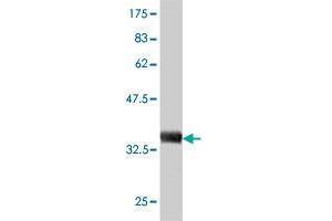 beta-2 Microglobulin 抗体  (AA 1-119)