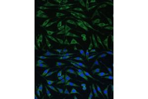 Immunofluorescence analysis of L929 cells using Dynamin 3 Polyclonal Antibody  at dilution of 1:100 (40x lens). (Dynamin 3 抗体  (AA 410-555))
