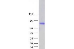 Western Blotting (WB) image for Sex Comb On Midleg-Like 1 (SCML1) (Transcript Variant 1) protein (Myc-DYKDDDDK Tag) (ABIN2731486)