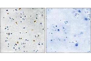 Immunohistochemistry analysis of paraffin-embedded human brain tissue, using DIL-2 Antibody. (TPX2 抗体  (AA 301-350))