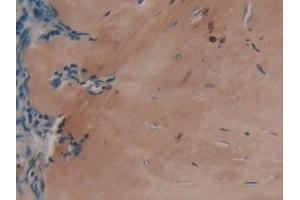 Immunohistochemistry (IHC) image for anti-Collagen, Type I, alpha 1 (COL1A1) (AA 253-471) antibody (ABIN7443395)