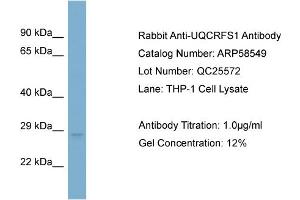 WB Suggested Anti-UQCRFS1  Antibody Titration: 0.