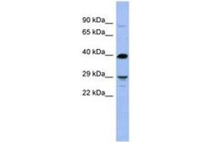 Image no. 1 for anti-Oligodendrocyte Transcription Factor 3 (OLIG3) (N-Term) antibody (ABIN6742934) (OLIG3 抗体  (N-Term))
