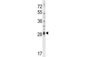IL17D antibody western blot analysis in NCI-H460 lysate. (IL17D 抗体  (AA 155-183))
