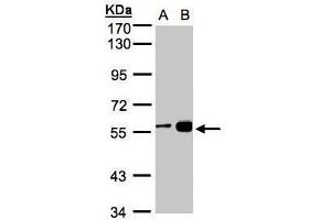 WB Image Sample(30 ug whole cell lysate) A:H1299 B:MOLT4 , 7. (RCC2 抗体)