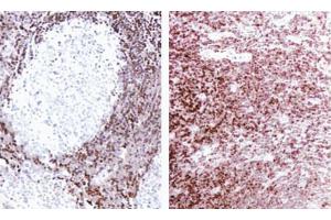 Formalin-fixed, paraffin-embedded tissue sections stained for Bcl-2 expression using clone Bcl-2/100 and the SA-HRP method. (Bcl-2 抗体  (AA 41-54))