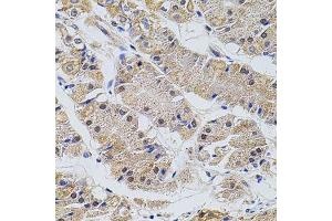 Immunohistochemistry of paraffin-embedded human stomach using TRMT2A antibody. (TRMT2A 抗体  (C-Term))