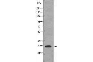 Western blot analysis of extracts from COLO205 cells, using TNFSF15 antibody. (TNFSF15 抗体  (C-Term))
