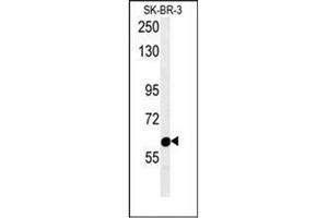 Western blot analysis of RADIL Antibody (C-term) in SK-BR-3 cell line lysates (15ug/lane). (Radil 抗体  (C-Term))