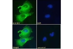 Immunofluorescence (IF) image for anti-Sonic Hedgehog (SHH) (C-Term) antibody (ABIN6391361)