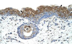 EIF2A antibody was used for immunohistochemistry at a concentration of 4-8 ug/ml to stain Epidermal cells (arrows) in Human Skin. (EIF2A 抗体  (C-Term))
