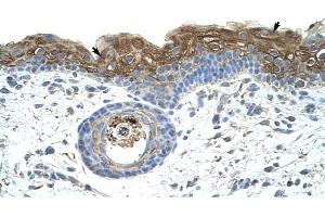 EIF2A antibody was used for immunohistochemistry at a concentration of 4-8 ug/ml to stain Epidermal cells (arrows) in Human Skin.
