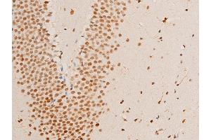 Immunohistochemistry (IHC) image for anti-Receptor tyrosine-protein kinase erbB-2 (ErbB2/Her2) (pTyr1248) antibody (ABIN6256630)