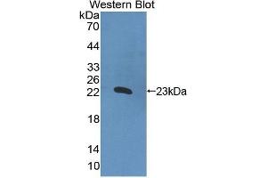 Western Blotting (WB) image for anti-Interleukin 2 (IL2) (AA 1-142) antibody (ABIN3201181) (IL-2 抗体  (AA 1-142))