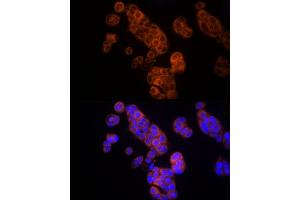 Immunofluorescence analysis of MCF7 cells using Thymidine Kinase 1 Rabbit pAb (ABIN6132726, ABIN6149198, ABIN6149199 and ABIN6221245) at dilution of 1:150 (40x lens). (TK1 抗体  (AA 1-234))