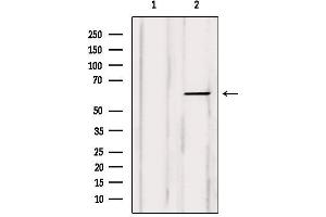 Western blot analysis of extracts from Myeloma cells, using COT Antibody. (MAP3K8 抗体  (Internal Region))
