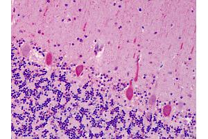 Anti-ACCN1 antibody IHC of human cerebellum.
