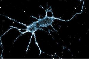 Immunofluorescence staining of rat neurons. (PKC iota 抗体  (AA 404-587))