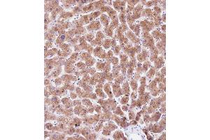 Immunohistochemical analysis of B on paraffin-embedded Human liver tissue. (PEMT 抗体  (C-Term))