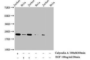 Western Blot Detected samples: Jurkat whole cell lysate, Hela whole cell lysate, Untreated (-) or treated (+) with Calyculin A and EGF All lanes: HIST1H1E antibody at 1:1000 Secondary Goat polyclonal to rabbit IgG at 1/40000 dilution Predicted band size: 22 kDa Observed band size: 22 kDa (HIST1H1E 抗体  (pThr17))