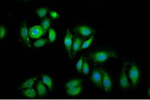 Immunofluorescence staining of A549 cells with ABIN7152126 at 1:100, counter-stained with DAPI. (EIF1 抗体  (AA 2-113))
