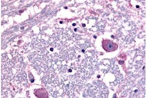 Immunohistochemistry (IHC) image for anti-Corticotropin Releasing Hormone Receptor 1 (CRHR1) (N-Term) antibody (ABIN1048461)