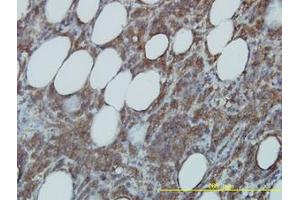 Image no. 1 for anti-Cell Division Cycle 37 Homolog (S. Cerevisiae) (CDC37) (AA 1-379) antibody (ABIN599169) (CDC37 抗体  (AA 1-379))